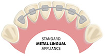 Appliance Standard